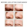 Blackhead Remover Tools -15g Blackhead Creamwith 40Pcs Blackhead Pore Strips