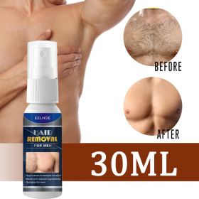 10Ml/20Ml/30Ml/50Ml Ontharing Spray Haargroei Remmer Natuurlijke Pijnloos Permanente ontharingscrème Huidverzorging Product (Color: Man 30ml)