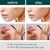 Warts Remover Patch Skin Tags Pimple Treatment Cream Hydrocolloid Gel Mole Wart Meat Grain Flat Silk Warts Invisible Stickers